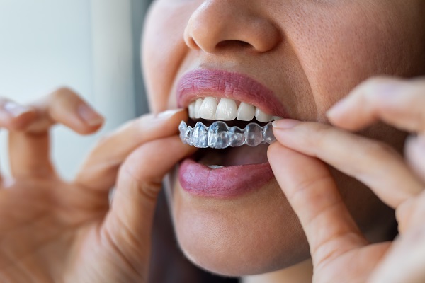 An Orthodontist Discusses Invisalign Invisible Braces - Oak Tree Dental  McLean Virginia